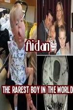 Watch Aidan The Rarest Boy In The World Wolowtube