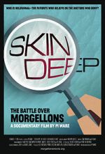 Watch Skin Deep: The Battle Over Morgellons Wolowtube