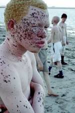 Watch Albino United Wolowtube