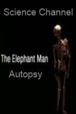 Watch Science Channel Elephant Man Autopsy Wolowtube