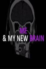 Watch Me & My New Brain Wolowtube