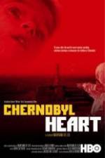 Watch Chernobyl Heart Wolowtube