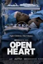 Watch Open Heart Wolowtube