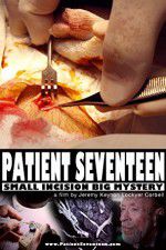 Watch Patient Seventeen Wolowtube