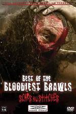 Watch TNA Wrestling: Best of the Bloodiest Brawls - Scars and Stitches Wolowtube