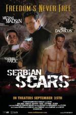 Watch Serbian Scars Wolowtube