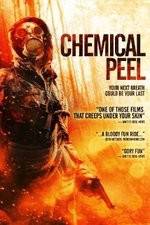 Watch Chemical Peel Wolowtube