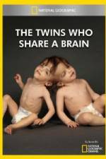 Watch National Geographic The Twins Who Share A Brain Wolowtube