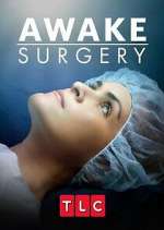 Watch Awake Surgery Wolowtube